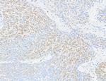 RBM9 Antibody in Immunohistochemistry (Paraffin) (IHC (P))