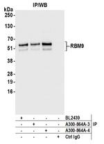 RBM9 Antibody in Immunoprecipitation (IP)