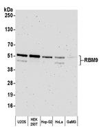 RBM9 Antibody in Western Blot (WB)