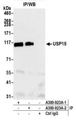 USP15 Antibody in Immunoprecipitation (IP)