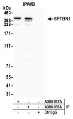 SPTBN1 Antibody in Immunoprecipitation (IP)