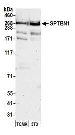 SPTBN1 Antibody in Western Blot (WB)