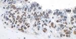 Topo II Beta Antibody in Immunohistochemistry (Paraffin) (IHC (P))