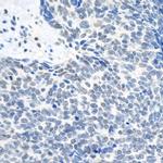 Topo II Beta Antibody in Immunohistochemistry (Paraffin) (IHC (P))