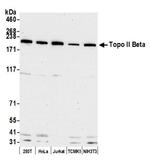 Topo II Beta Antibody in Western Blot (WB)