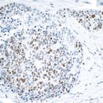 FALZ/BPTF Antibody in Immunohistochemistry (Paraffin) (IHC (P))