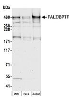 FALZ/BPTF Antibody in Western Blot (WB)