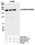 SMARCA2/BRM Antibody in Immunoprecipitation (IP)