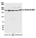 SMARCA2/BRM Antibody in Western Blot (WB)