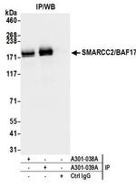 SMARCC2/BAF170 Antibody in Immunoprecipitation (IP)