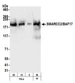 SMARCC2/BAF170 Antibody in Western Blot (WB)