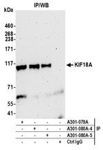 KIF18A Antibody in Immunoprecipitation (IP)