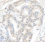 SMARCB1/SNF5 Antibody in Immunohistochemistry (Paraffin) (IHC (P))