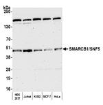 SMARCB1/SNF5 Antibody in Western Blot (WB)