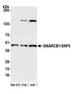 SMARCB1/SNF5 Antibody in Western Blot (WB)