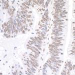 XRN2 Antibody in Immunohistochemistry (Paraffin) (IHC (P))