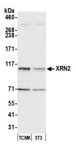 XRN2 Antibody in Western Blot (WB)