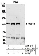 UBE4B Antibody in Immunoprecipitation (IP)