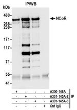 NCoR Antibody in Immunoprecipitation (IP)