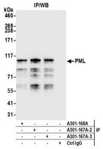 PML Antibody in Immunoprecipitation (IP)