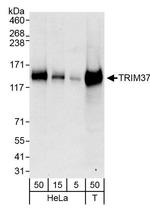 TRIM37 Antibody in Western Blot (WB)