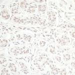 CHD8 Antibody in Immunohistochemistry (Paraffin) (IHC (P))