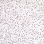 CHD8 Antibody in Immunohistochemistry (Paraffin) (IHC (P))