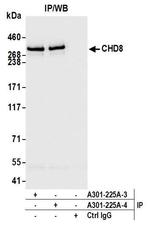 CHD8 Antibody in Immunoprecipitation (IP)