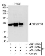 PSF/SFPQ Antibody in Immunoprecipitation (IP)