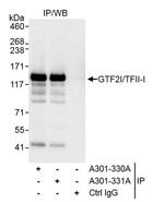 GTF2I/TFII-I Antibody in Immunoprecipitation (IP)