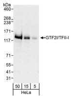 GTF2I/TFII-I Antibody in Western Blot (WB)