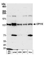 CP110 Antibody in Western Blot (WB)