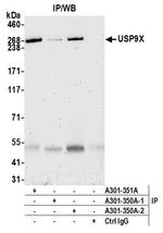 USP9X Antibody in Immunoprecipitation (IP)