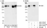 CAD Antibody in Western Blot (WB)