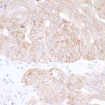 CAD Antibody in Immunohistochemistry (Paraffin) (IHC (P))