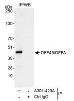 DFF45/DFFA Antibody in Immunoprecipitation (IP)
