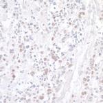 WDR79 Antibody in Immunohistochemistry (Paraffin) (IHC (P))