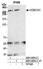 CCDC131 Antibody in Immunoprecipitation (IP)