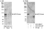 eEF2 Kinase Antibody in Western Blot (WB)