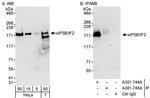 eIF5B/IF2 Antibody in Western Blot (WB)