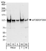 eIF3B/EIF3S9 Antibody in Western Blot (WB)