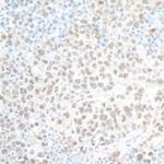 PHF8 Antibody in Immunohistochemistry (Paraffin) (IHC (P))