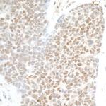 PHF8 Antibody in Immunohistochemistry (Paraffin) (IHC (P))