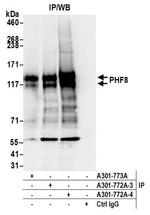 PHF8 Antibody in Immunoprecipitation (IP)