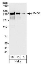 eIF4G1/eIF4GI Antibody in Western Blot (WB)