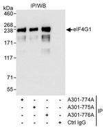 eIF4G1/eIF4GI Antibody in Immunoprecipitation (IP)