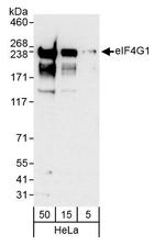 eIF4G1/eIF4GI Antibody in Western Blot (WB)