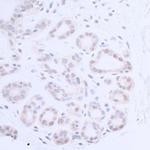 XPA Antibody in Immunohistochemistry (Paraffin) (IHC (P))