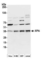 XPA Antibody in Western Blot (WB)