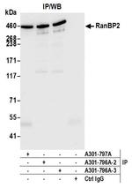 RanBP2 Antibody in Immunoprecipitation (IP)